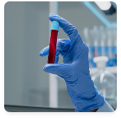 Blood / Pathology Test